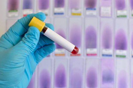 Novo exame de sangue promete detectar até 20 tipos de câncer