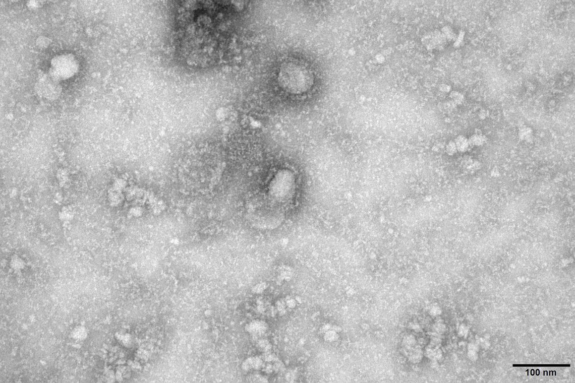 POR TEMPO INDETERMINADO | Governo Bolsonaro cria grupo para monitorar casos de coronavírus