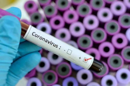 ATÉ 700 POR DIA | Saúde firma parceria com UnB para ampliar diagnósticos do coronavírus