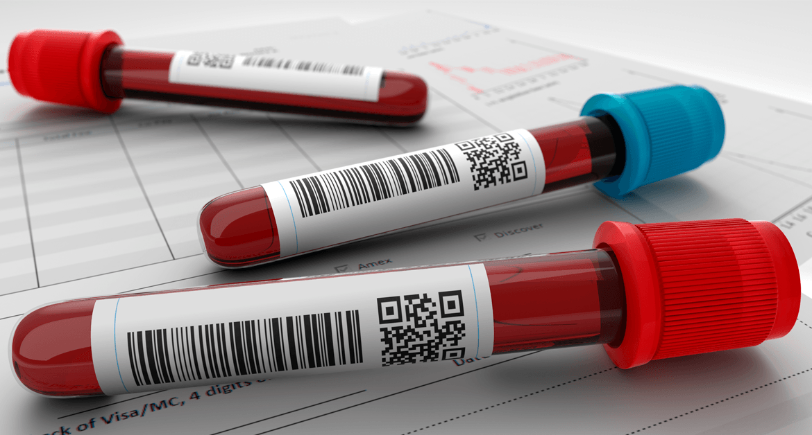 REFORÇO CONTRA O CORONAVÍRUS | Ibaneis determina a criação de equipes volantes para agilizar exames