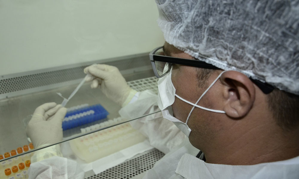 CERCA DE 100 MIL TESTES | GDF vai realizar a testagem para Covid-19 a partir de amanhã (21) na população