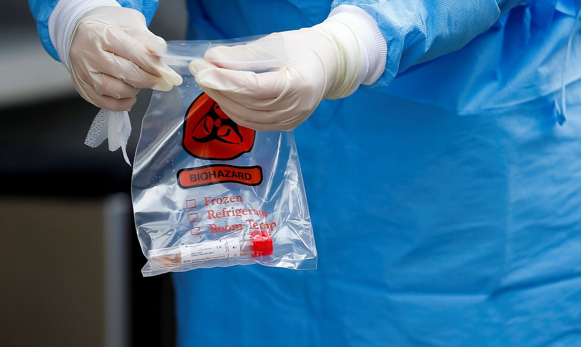 CORONAVÍRUS | Brasil registra 11.130 casos de covid-19 e 486 mortes