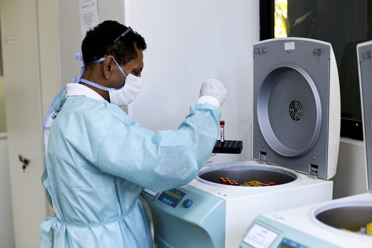 300 MIL TESTES | A partir desta terça (28), todas as unidades de Saúde do DF passarão a fazer exame da covid