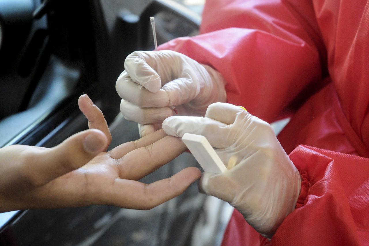 PARA REATIVAR DRIVE-THRU | GDF abre processo para comprar 100 mil testes rápidos de covid