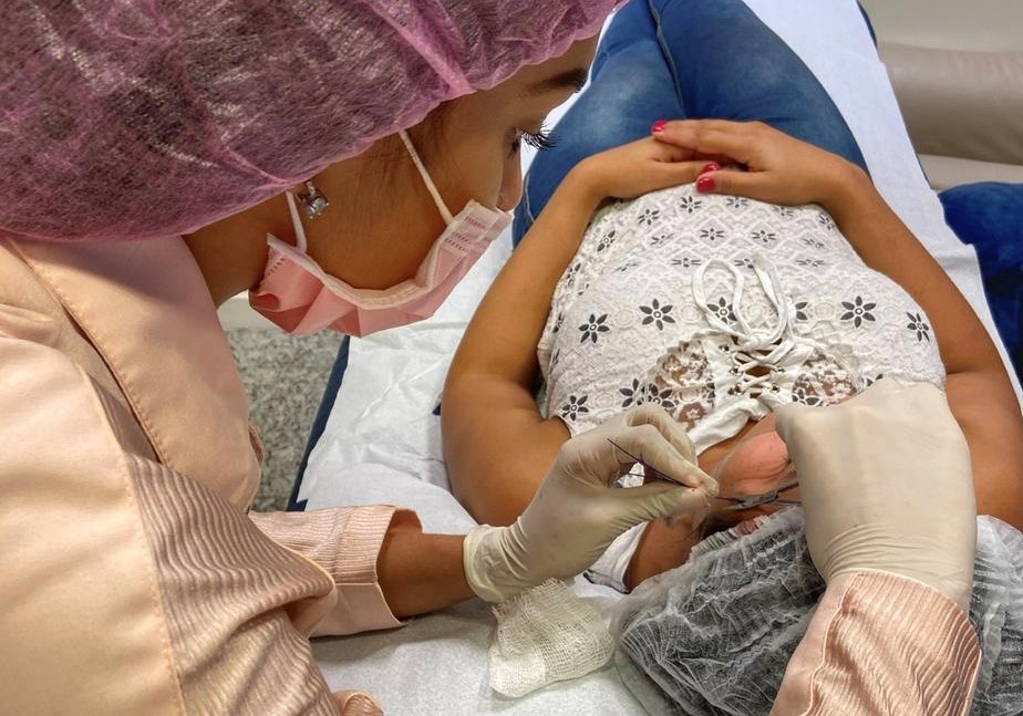 TALASSO SPA & SAÚDE ESTÉTICA | Você conhece os Fios de Sustentação PDO?