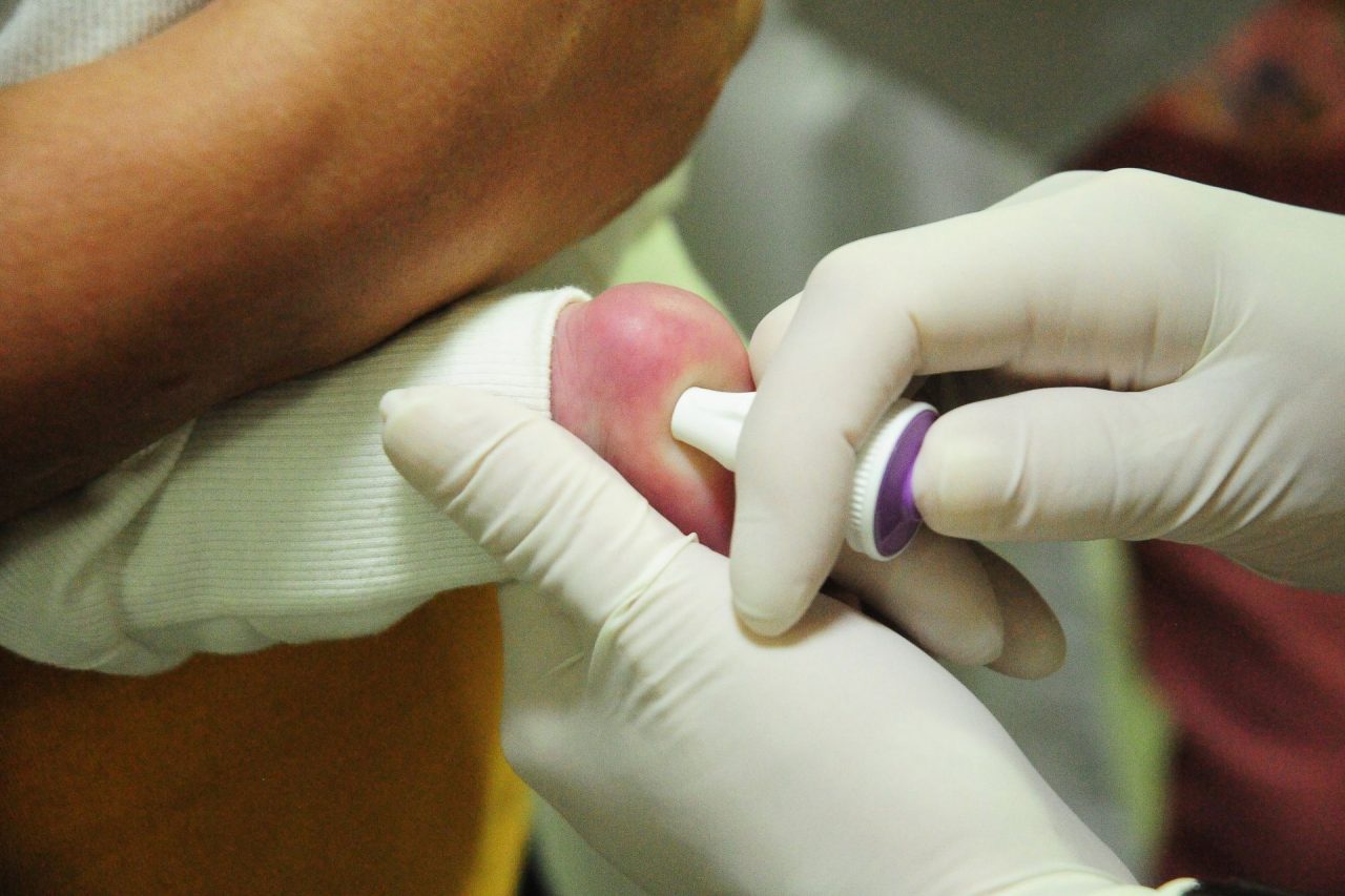 REFERÊNCIA PARA O PAÍS | Teste do Pezinho realizado pela rede pública do DF é o que identifica mais doenças em crianças