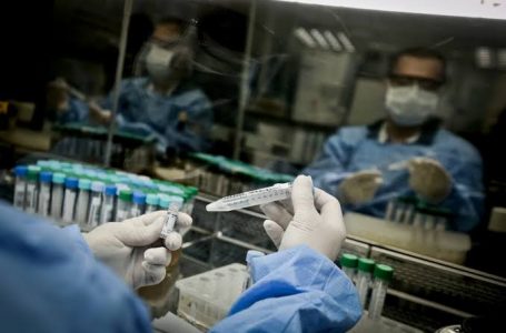CORONAVÍRUS NO DF | Sec. de Saúde confirma o registro do primeiro caso de reinfecção da variante indiana Delta