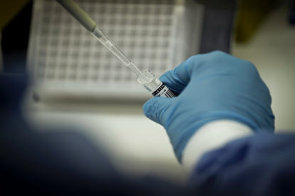 COVID NO DF | Lacen registra queda de casos da doença