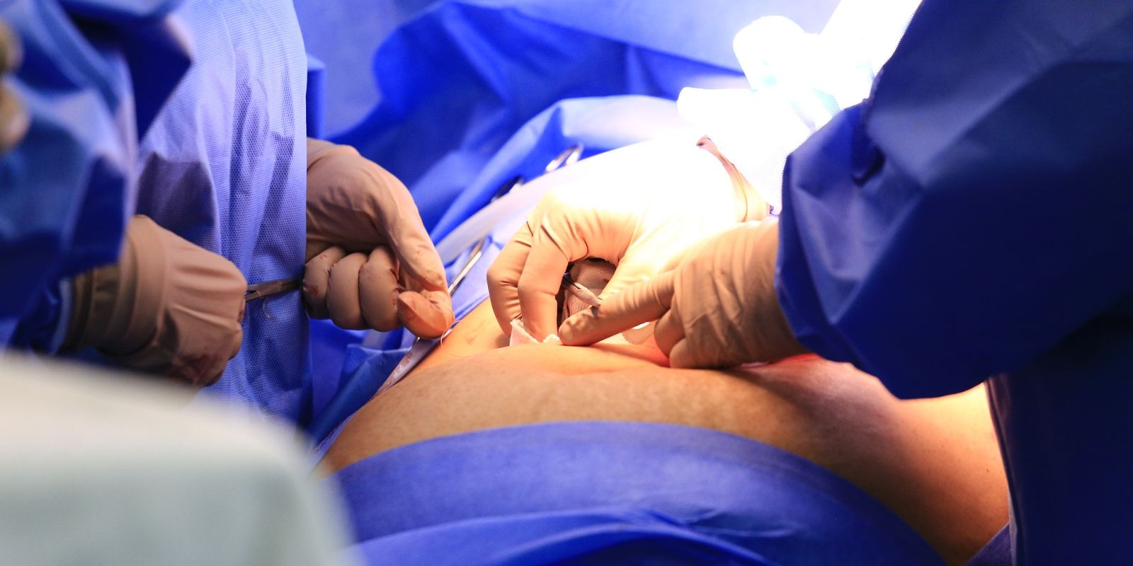 PARA ZERAR AS FILAS | Hospitais contratados pelo GDF deram início ao mutirão de mais 3,2 mil cirurgias eletivas