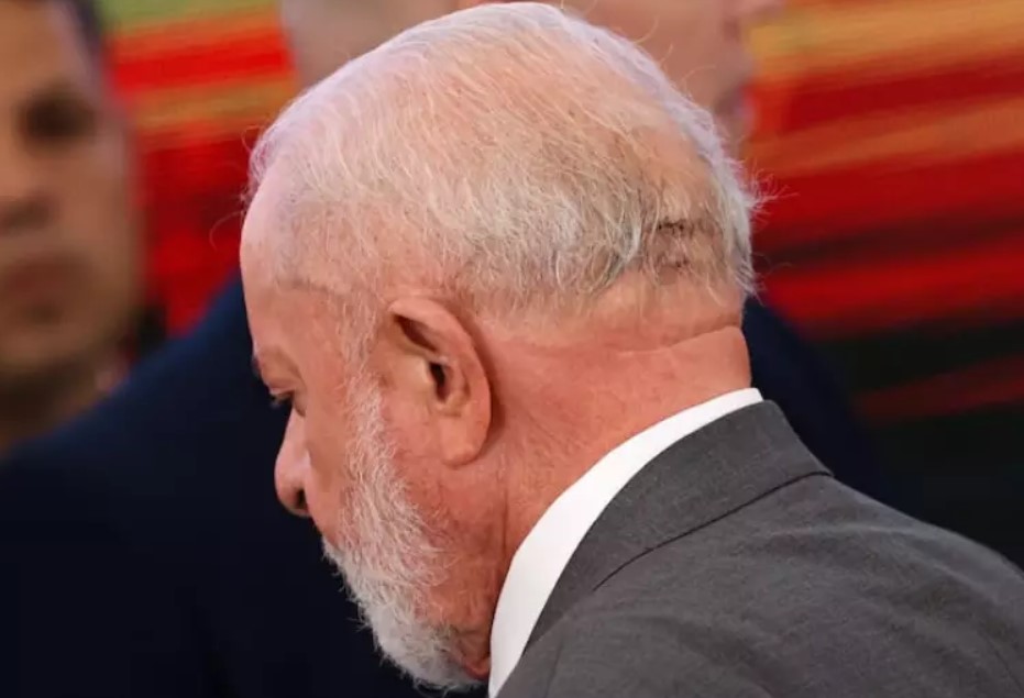 APÓS SENTIR FORTES DORES DE CABEÇA | Lula passa por cirurgia de emergência em São Paulo para drenar hematoma