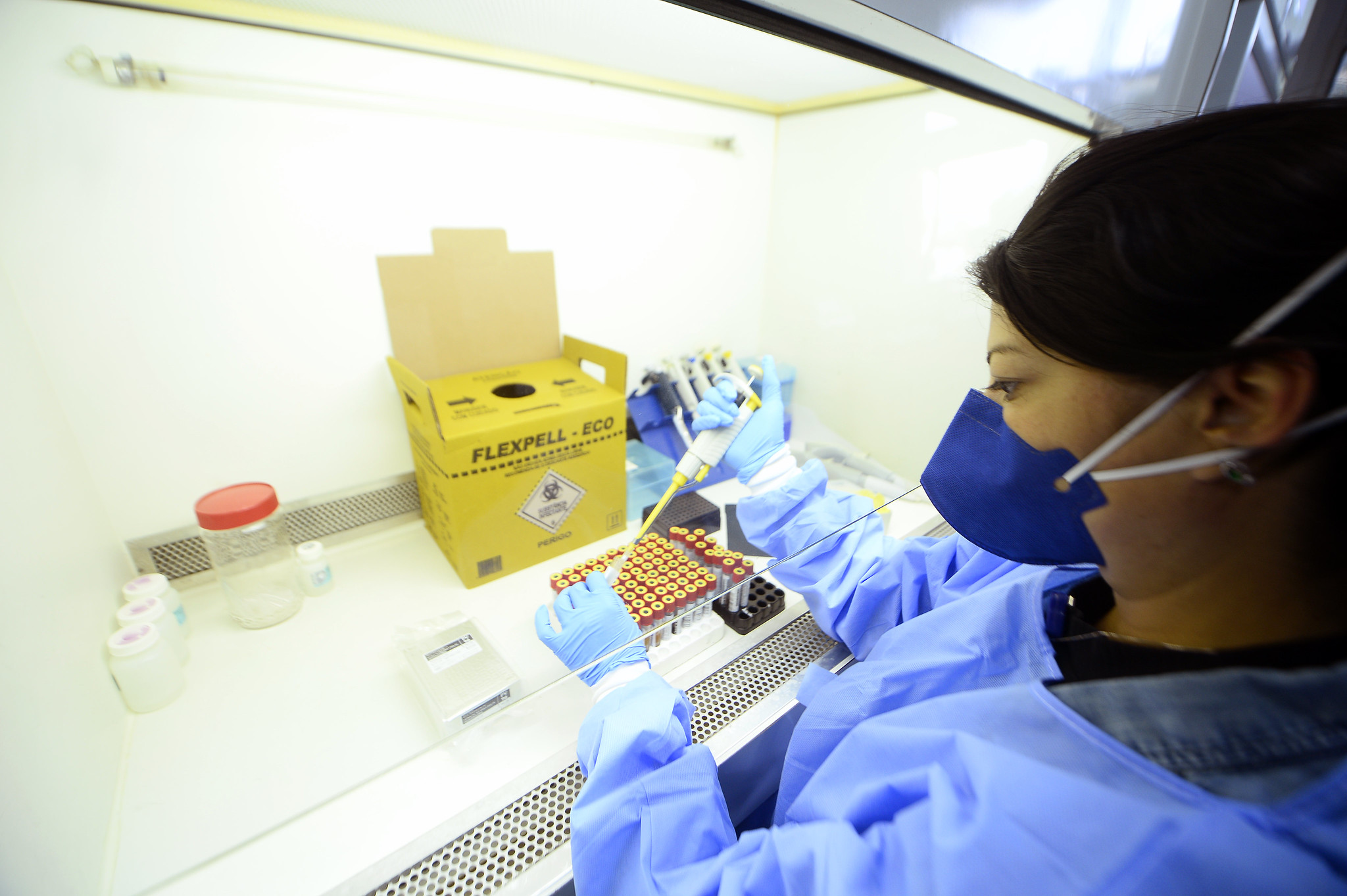 Mais agilidade: Secretaria de Saúde amplia monitoramento contra viroses gripais e agiliza exames no DF